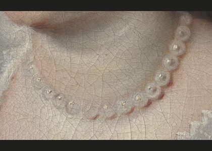 Fig. 26a. Change in the position of the pearl necklace